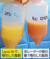 「LipoLife（ライポライフ）」で生着率アップ！