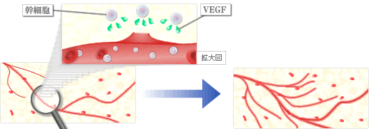 新しい血管の形成を促す成分（VEGFなど）を分泌