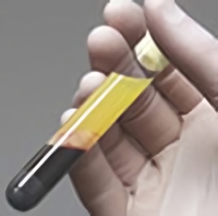 New-PRP皮膚再生療法とは？