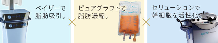 ベイザーで脂肪吸引 ピュアグラフトで脂肪濃縮 セリューションで幹細胞を活性化