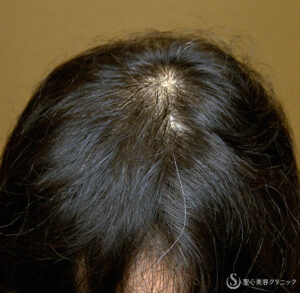 After
