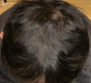 After