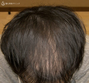 After