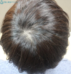 After