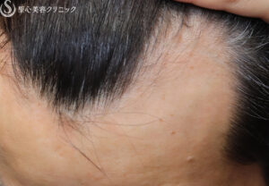 After