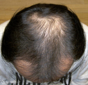 After