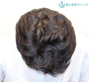 After