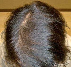 After