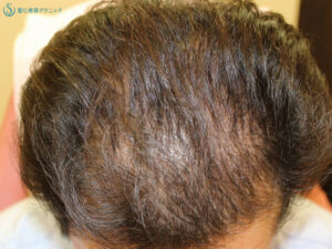 Before