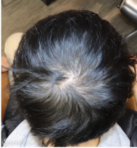 Before