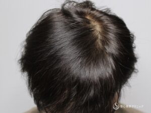 After