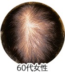 60代女性