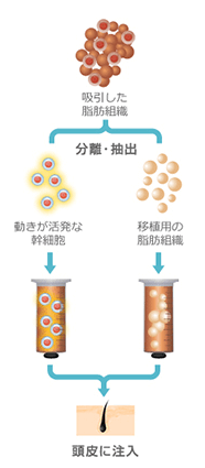 治療の流れ