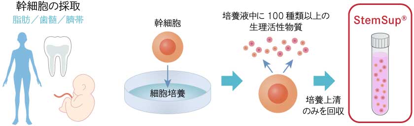 安心・安全な製剤(StemSup™)で美しく確実にバストアップ